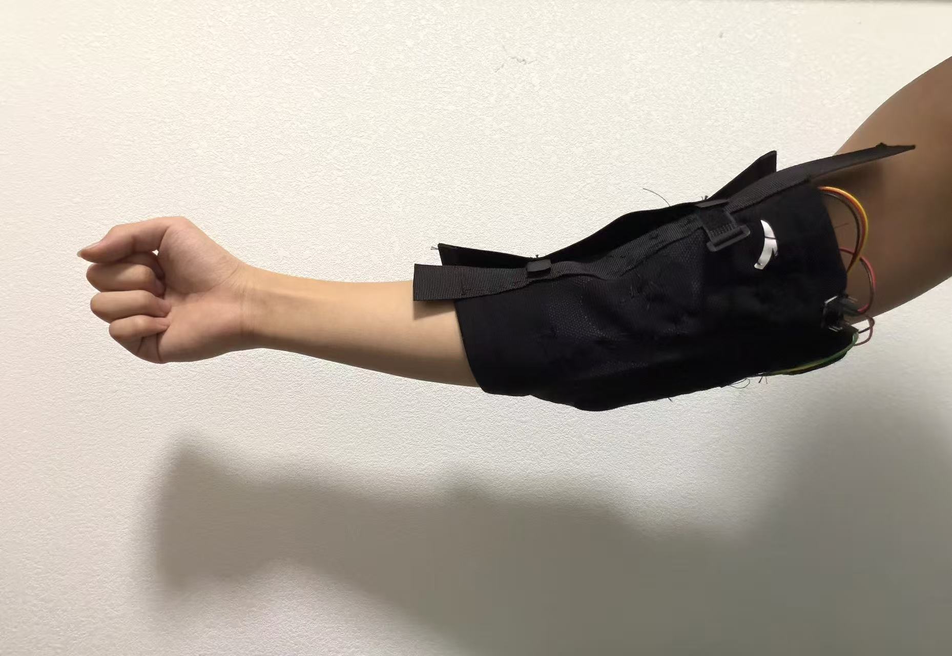 IMSES prototype worn on arm
